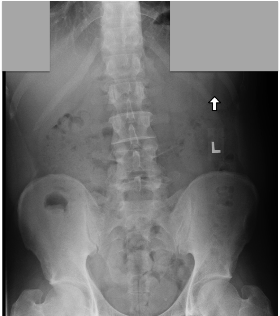 X-Ray Front View