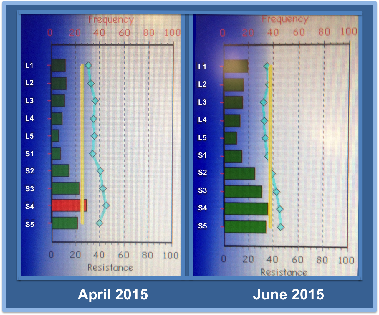 Pro Adjuster 3 Month Back Update