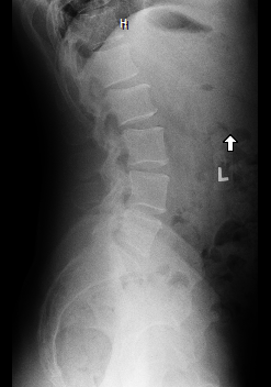 X-Ray Side View